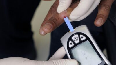 Berikut Lima Tanda-tanda Kolesterol Tinggi pada Wanita